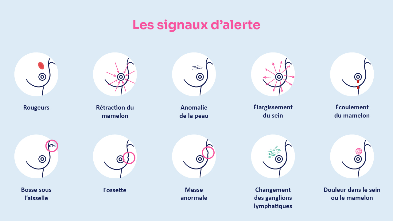 l-autopalpation-mammaire-parlons-en-partenamut-mutualit-libre-en